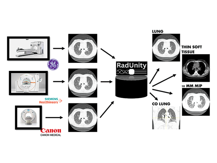 RadUnity’s software harmonizes medical images from different scanners and provides clinicians with a clearer picture of the most applicable data.