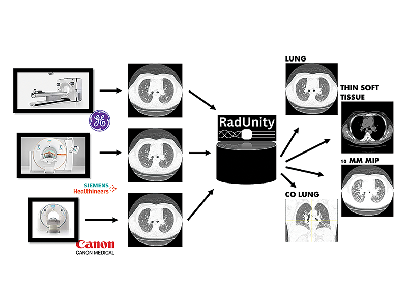 RadUnity’s software harmonizes medical images from different scanners and provides clinicians with a clearer picture of the most applicable data.