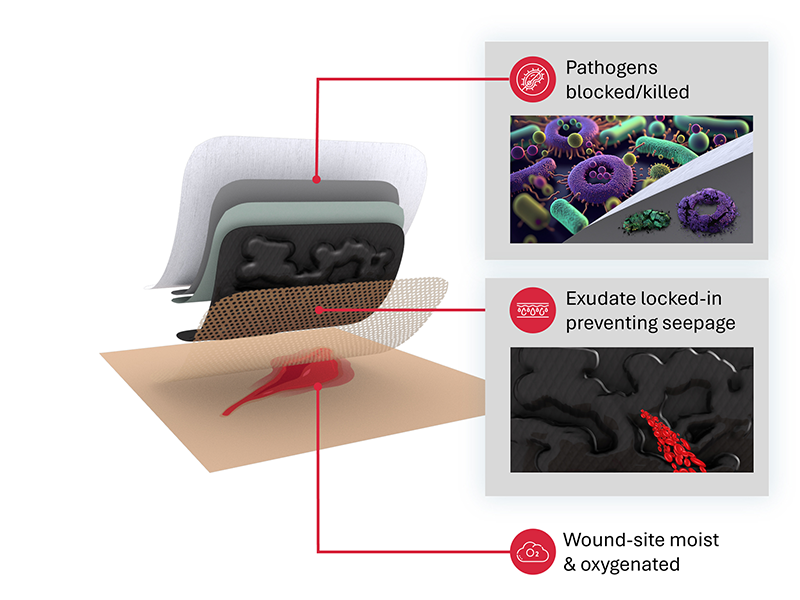 Ashwinraj Karthikeyan developed a dressing for wounds that uses activated carbon to improve the healing process.