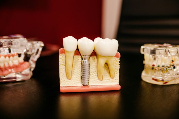 Models of teeth